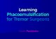 Gede Pardianto - Learning phacoemulsification for tremor surgeons