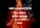 Inflammation : atherosclerosis, cancer, obesity, infections, dementia, depression