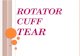 Rotator cuff tear