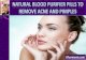 Natural Blood Purifier Pills To Remove Acne And Pimples