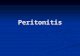 5801 Peritonitis