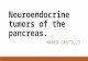 Neuroendocrine tumors of the pancreas
