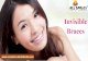 Invisible Braces in Bangalore | Best Dental Braces in India