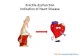 Erectile dysfunction indication of heart disease
