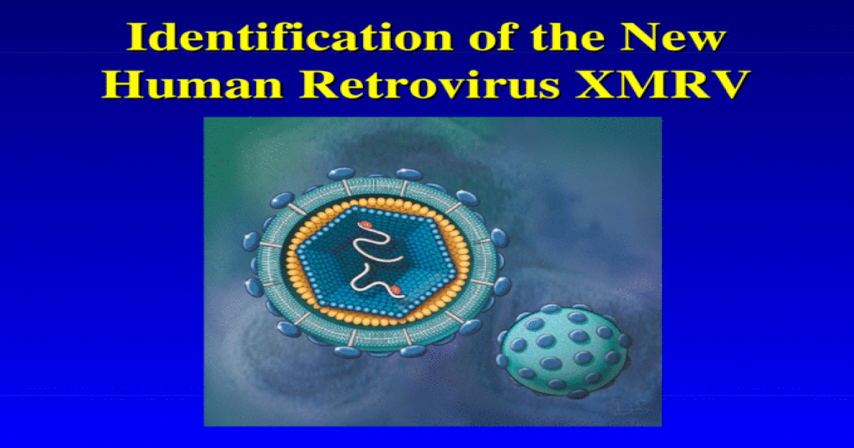 what is an example of a retrovirus in humans